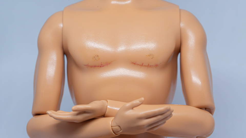 No Trans mutilation surgery for children without parental approval? How about none period
